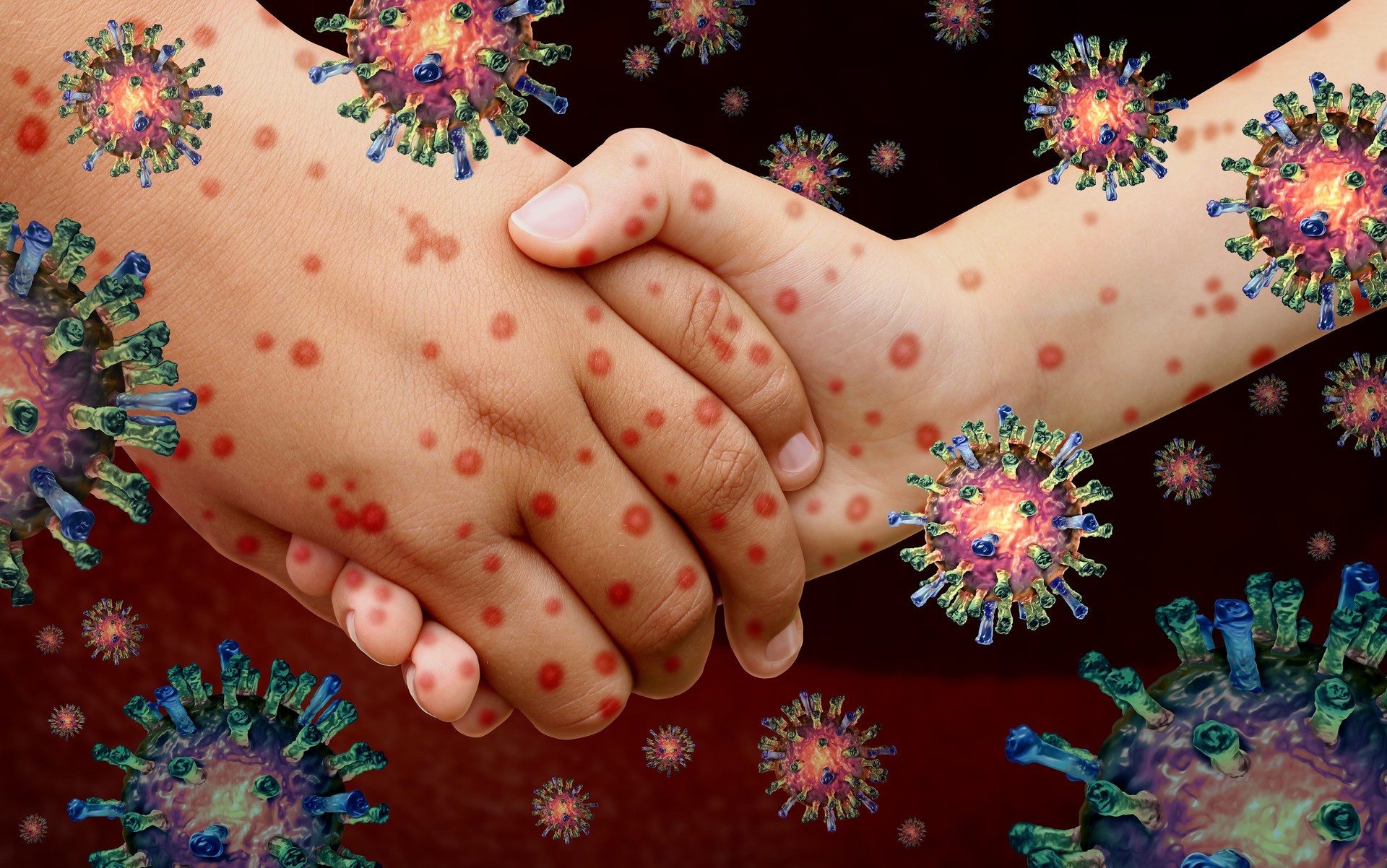 Viral Diseases