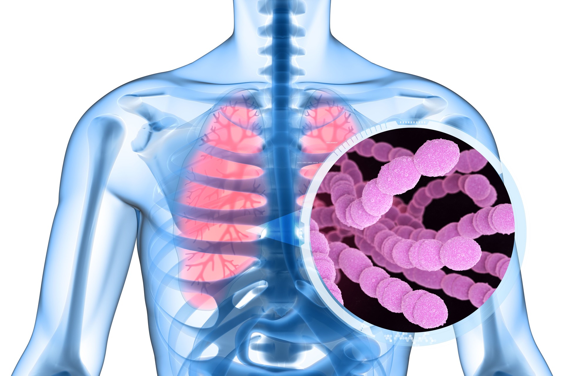 Streptococcus Pneumoniae Bacteria in Lungs