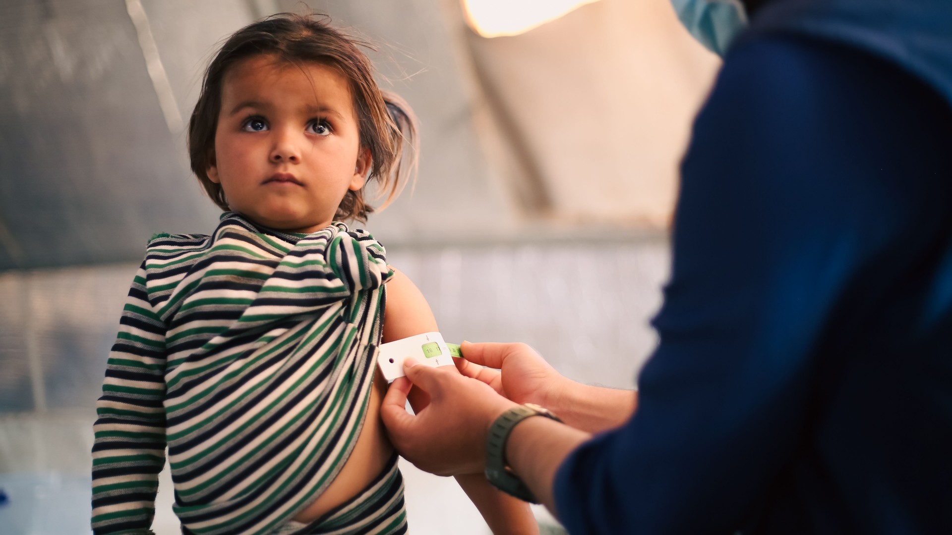 A doctor examines children's malnutrition inside a refugee camp.