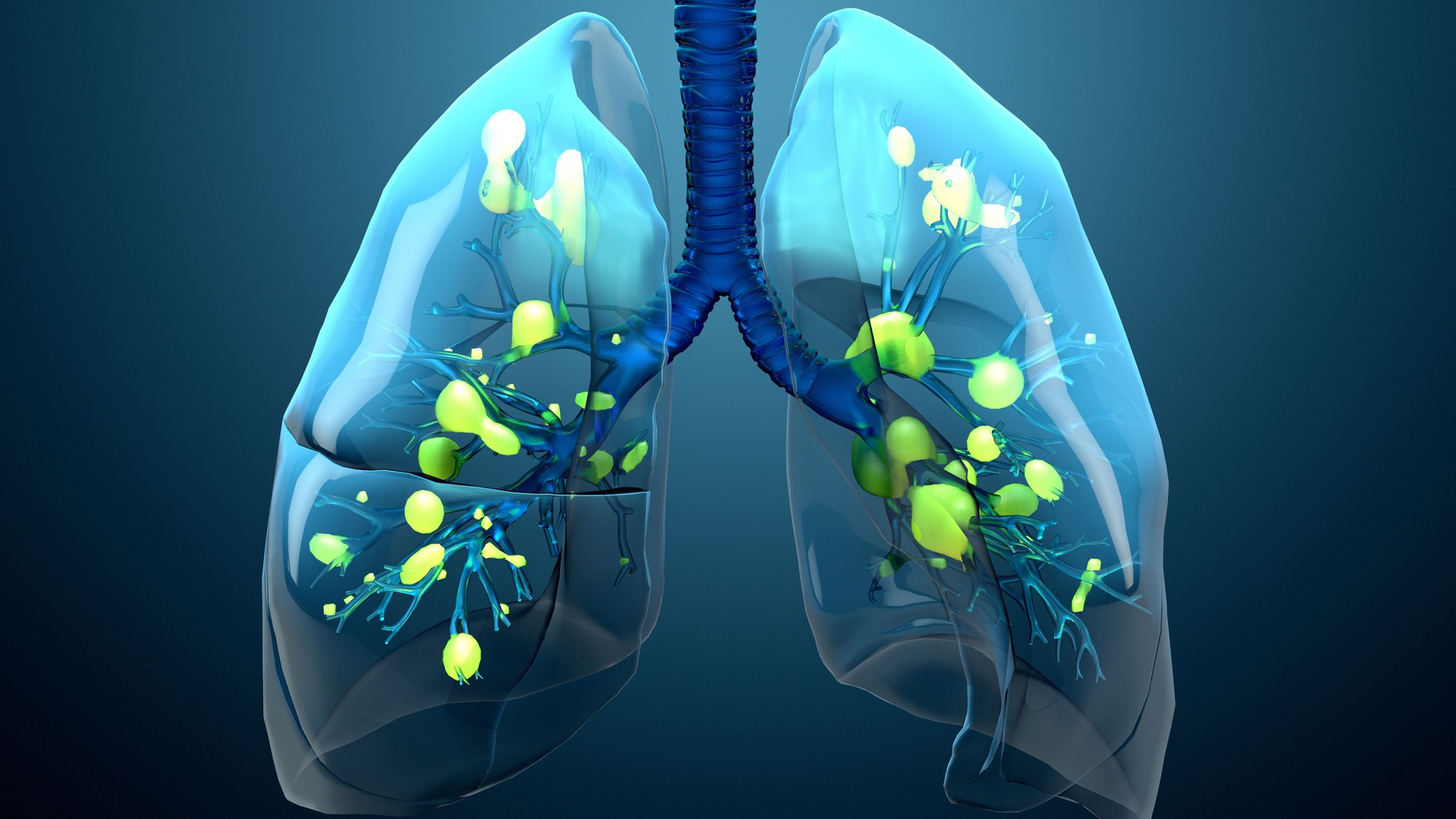 Damage lungs, severe respiratory illness, pneumonia, ARDS, acute respiratory distress syndrome caused by the coronavirus