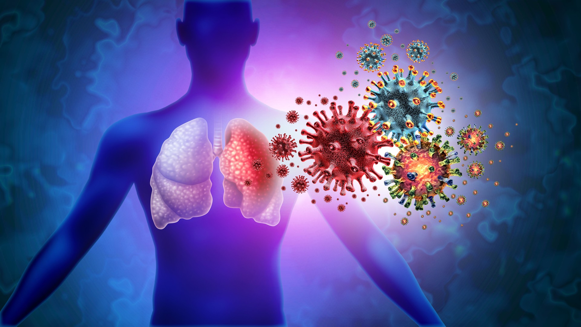 Triple Virus Lung Infection
