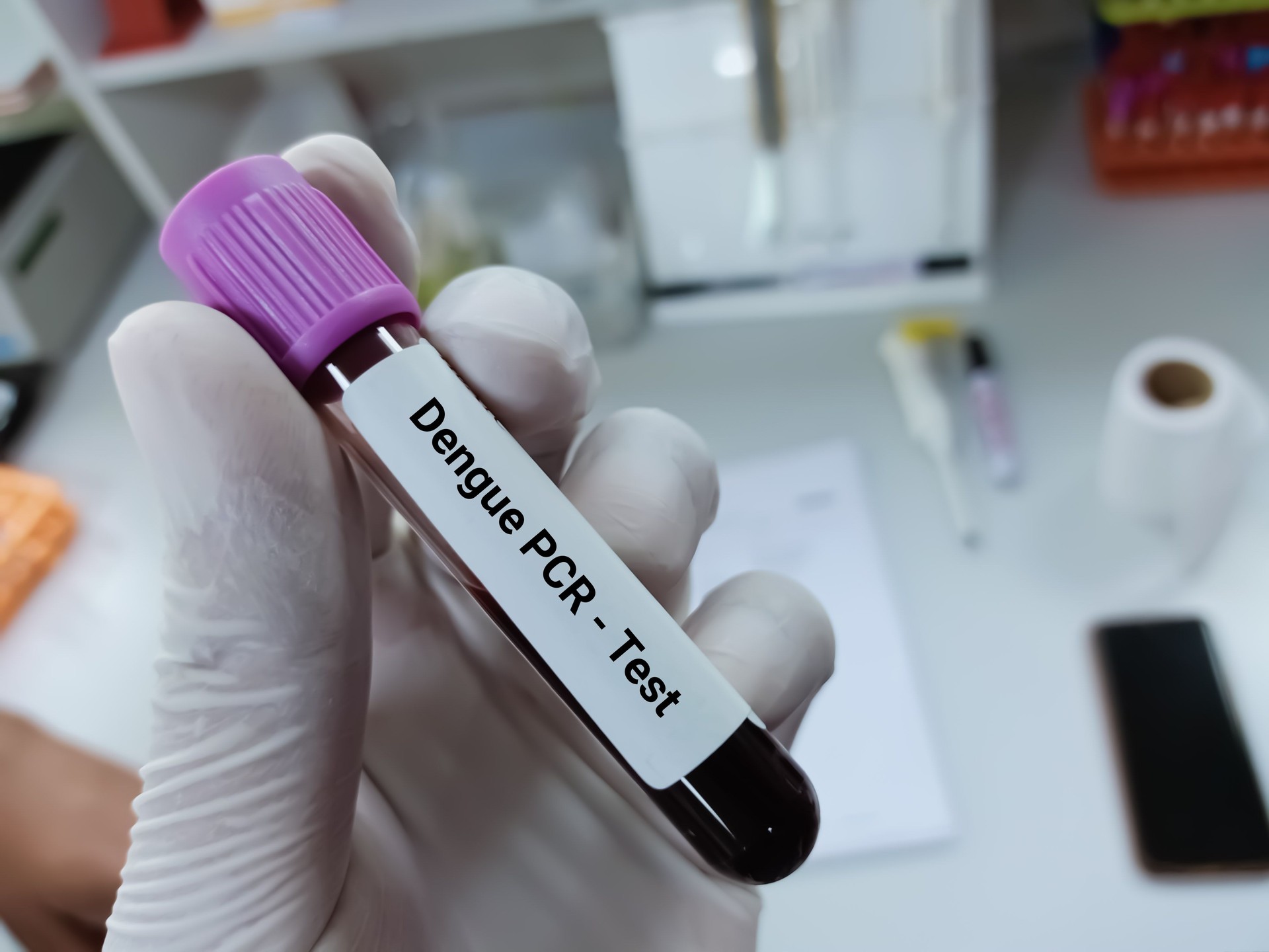 Biochemist of Scientist holds blood sample for Dengue Virus PCR test.